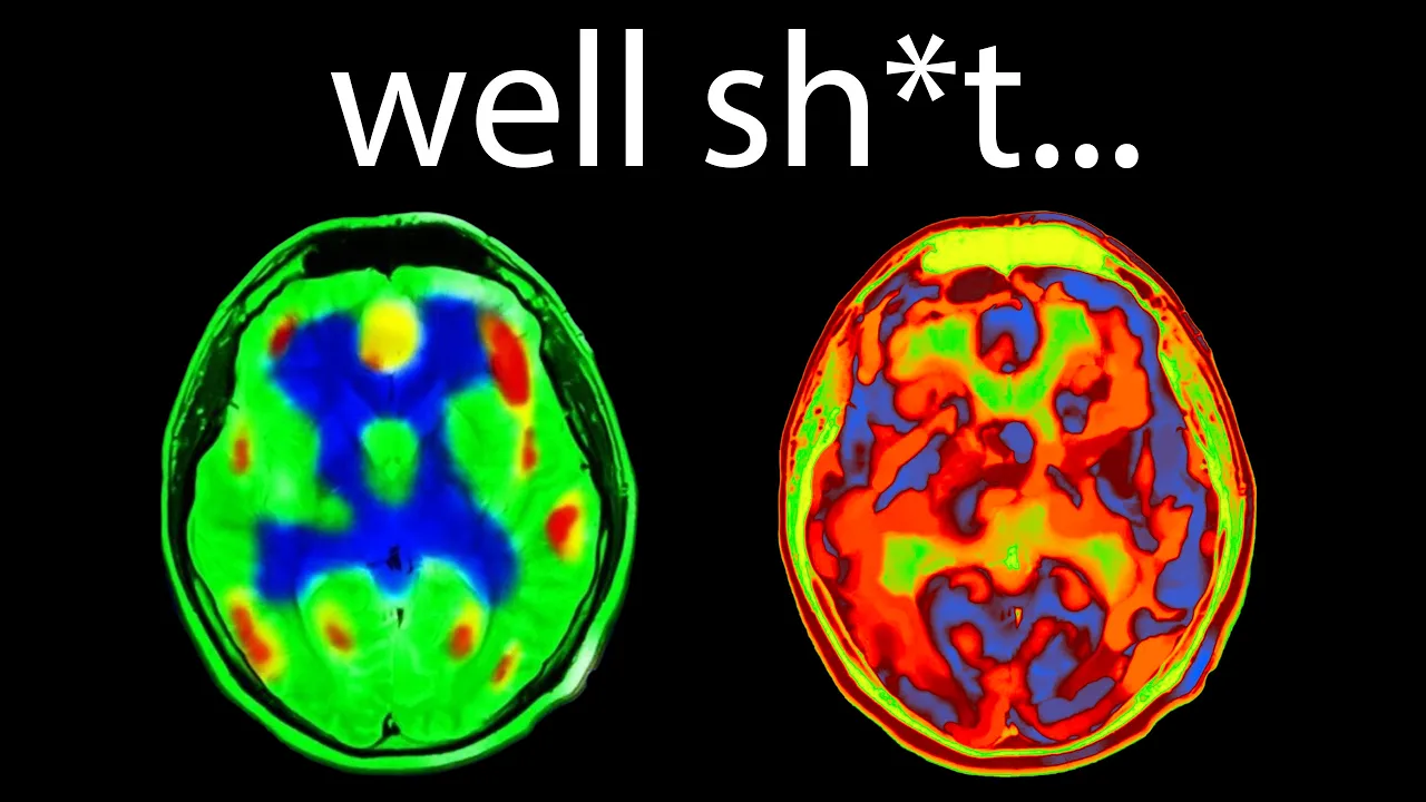 You'll NEVER Watch Short Form Again After Watching This